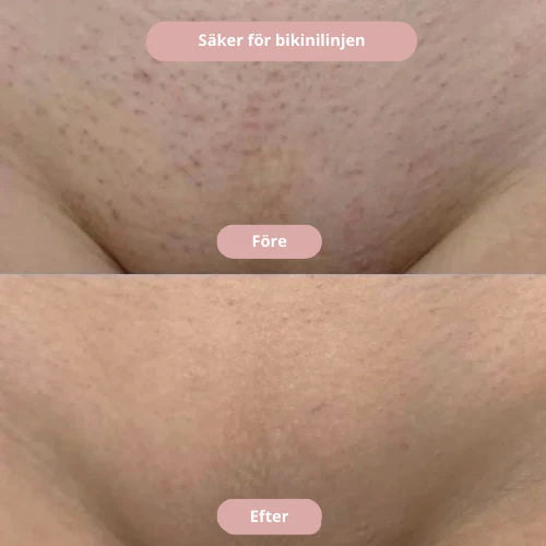 Silkyskin - Intimrakning utan irritation